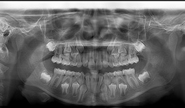 Radiografia Panorâmica