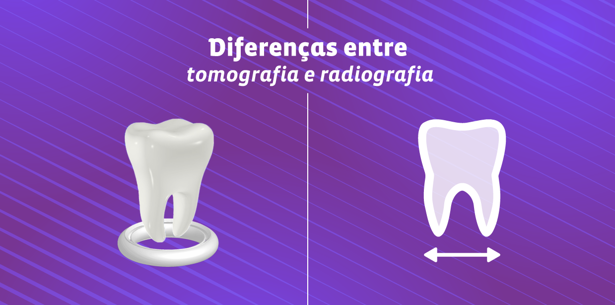 As diferenças entre os exames de tomografia e de radiografia